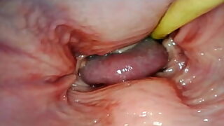 Anal creampie